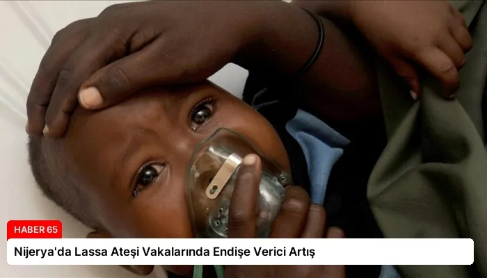 Nijerya’da Lassa Ateşi Vakalarında Endişe Verici Artış