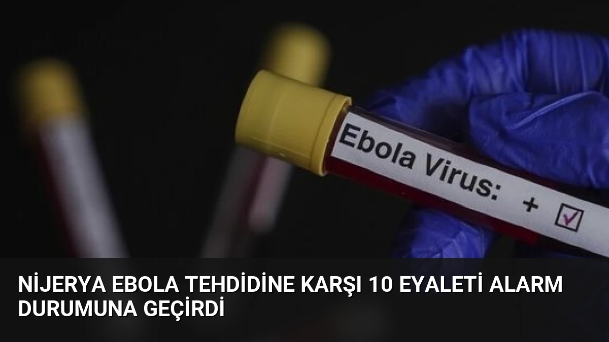 Nijerya Ebola Tehdidine Karşı 10 Eyaleti Alarm Durumuna Geçirdi